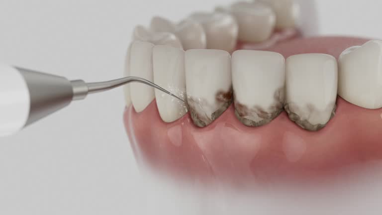 Trusted Tooth Extraction service in Berkley, MI - Dentist Open Now